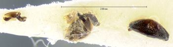 Media type: image;   Entomology 5996 Aspect: body parts